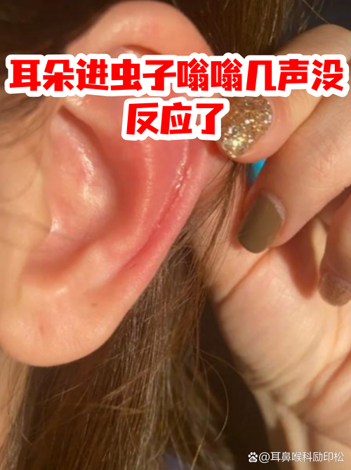 梦见老公耳朵里钻进虫子是什么预兆？有什么特殊含义吗？