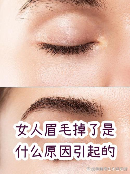 女人掉眉毛是什么原因引起的？有没有什么解决办法？