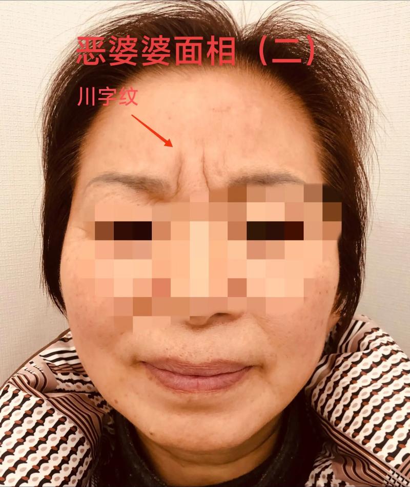 两眉间深沟形成川字纹，面相有何特殊含义？