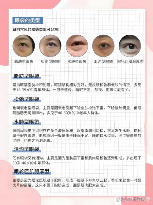 女人肿眼泡是福气的象征吗？肿眼泡形成的原因有哪些？