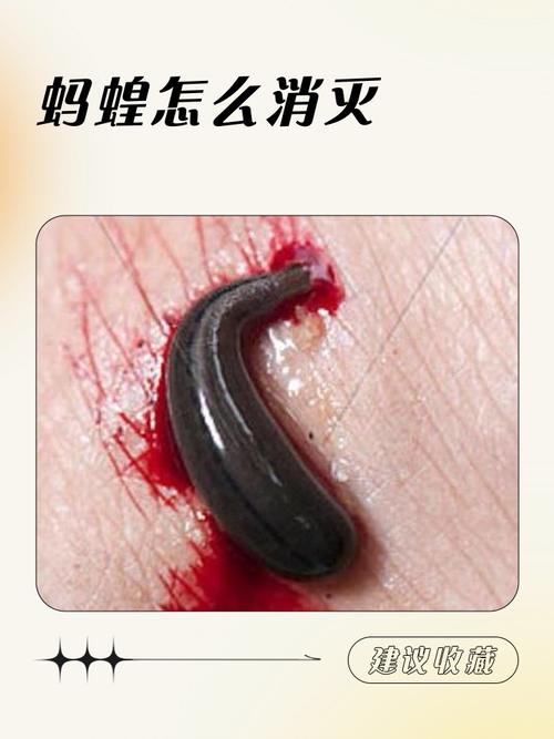 梦见被蚂蝗咬脚吸血是什么预兆？预示着什么不好的事情即将发生？