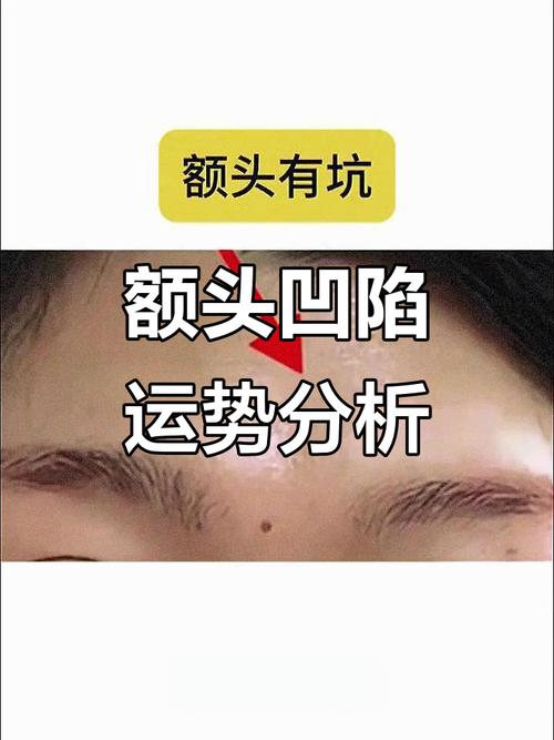 额头凹陷的面相是否影响运势和健康？