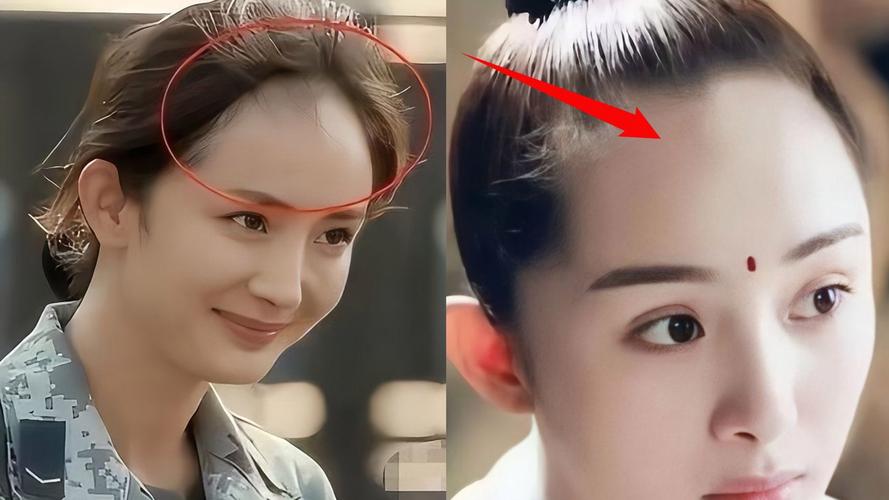 女人头顶中间秃，这样的面相命运会怎样？