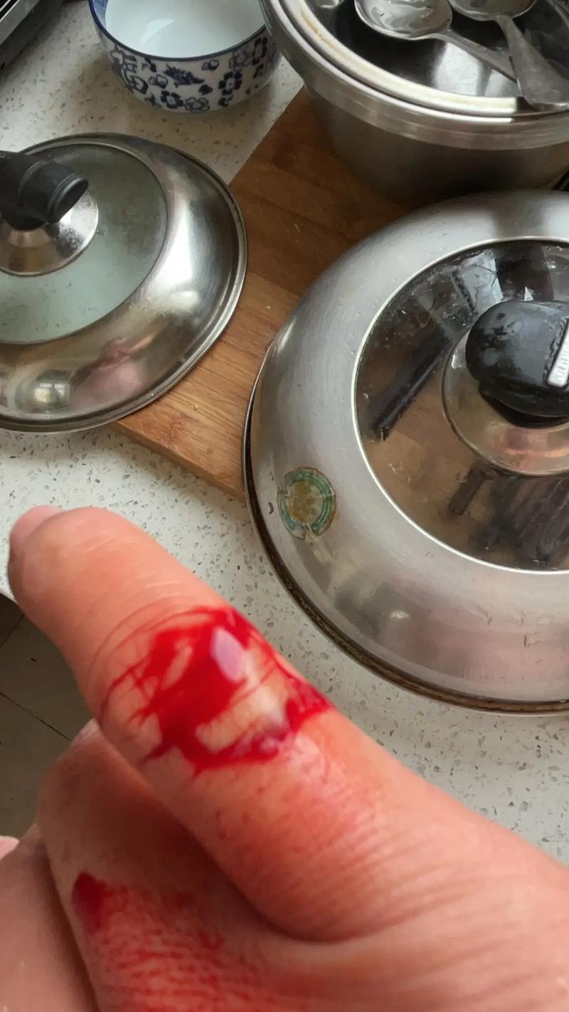 孕妇怀孕期间梦见手指被割破流血是什么征兆或含义？