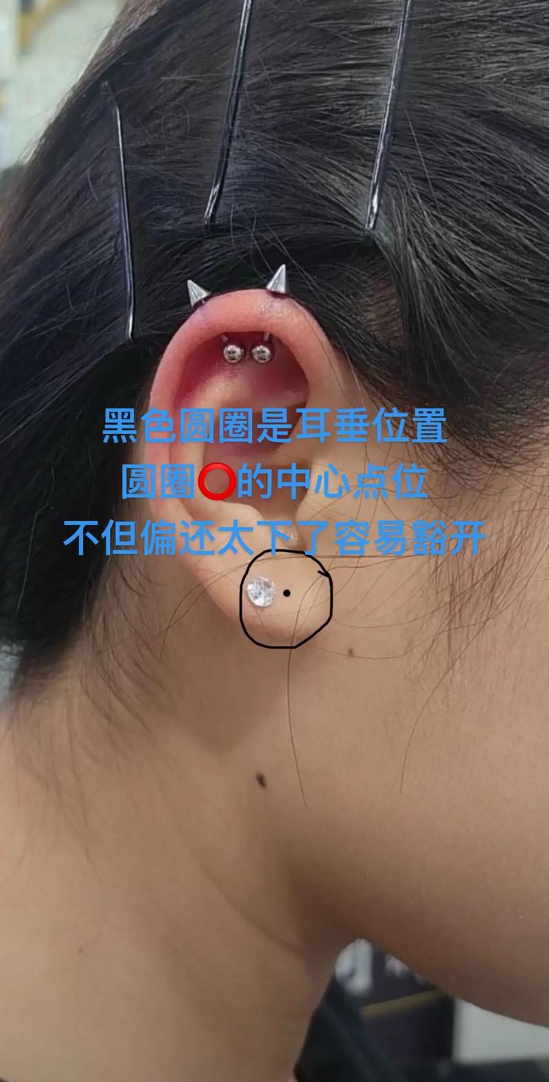 梦见打耳洞打歪了这预示着什么耳洞打错地方了有什么特殊含义？