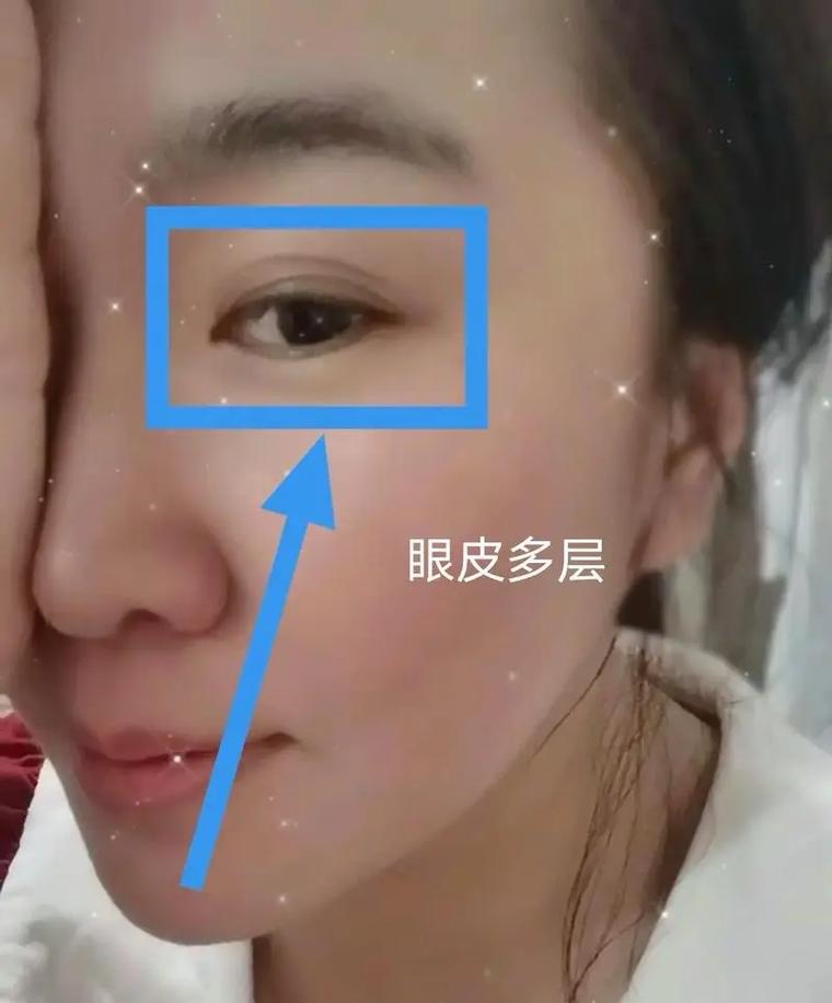 多层眼皮面相的女人面相好吗？代表什么含义？