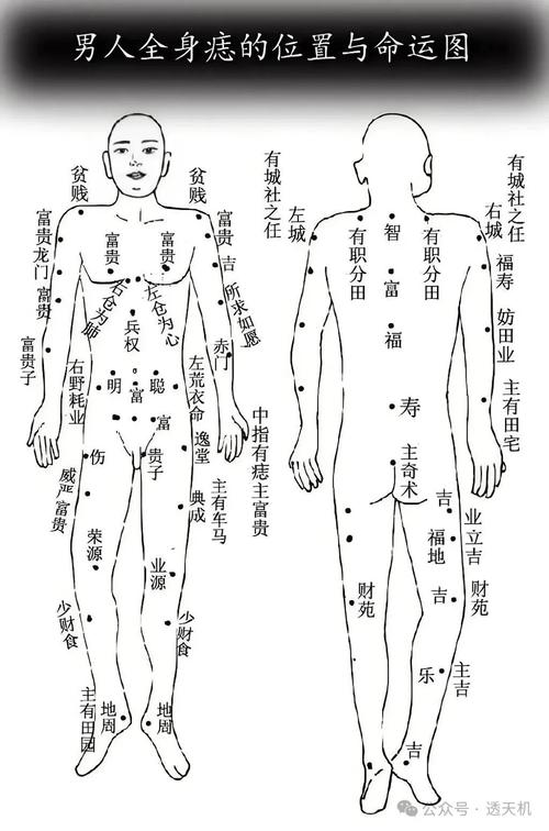 男人身上不同位置的痣预示着怎样的命运？