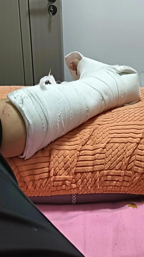 孕妇梦见别人腿被割皮是什么预兆或含义？