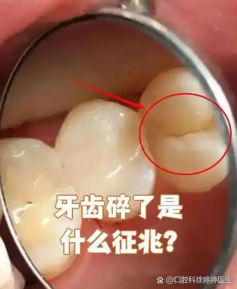 梦到牙齿碎裂并吐出，这预示着什么征兆或暗示？