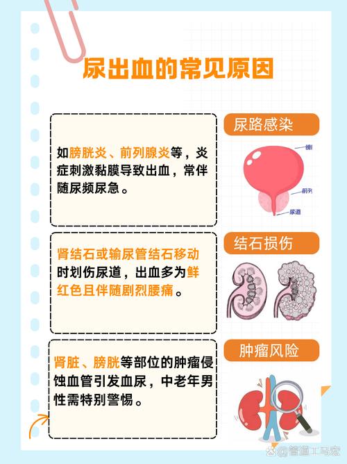男生梦见自己尿血是什么征兆？预示着什么不好的事情？