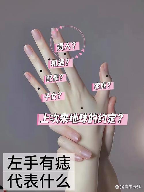 女人左手虎口有痣，她的命运究竟有何特殊寓意？