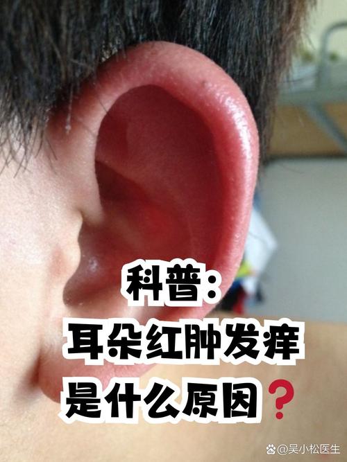 耳垂发红是不是预示着什么好征兆呢？