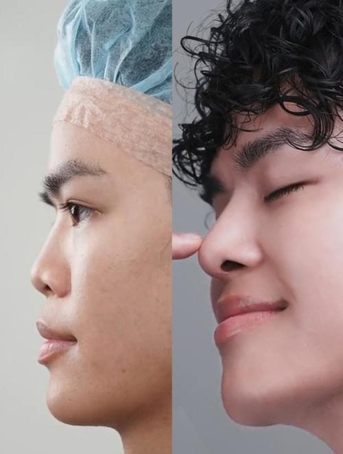 塌鼻子男孩的命运是否注定坎坷？