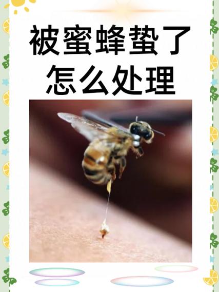 男人梦到被蜜蜂蛰预示着什么含义或有什么特殊象征？