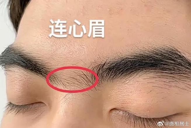 女人眉毛长得像钟馗，这是怎么回事呢？如何改善？