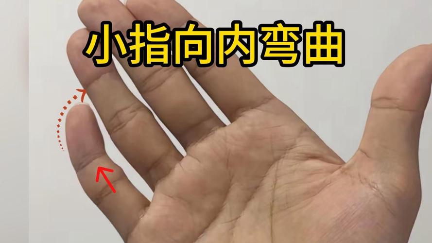 女人小拇指内弯，难道真的意味着命不好吗？