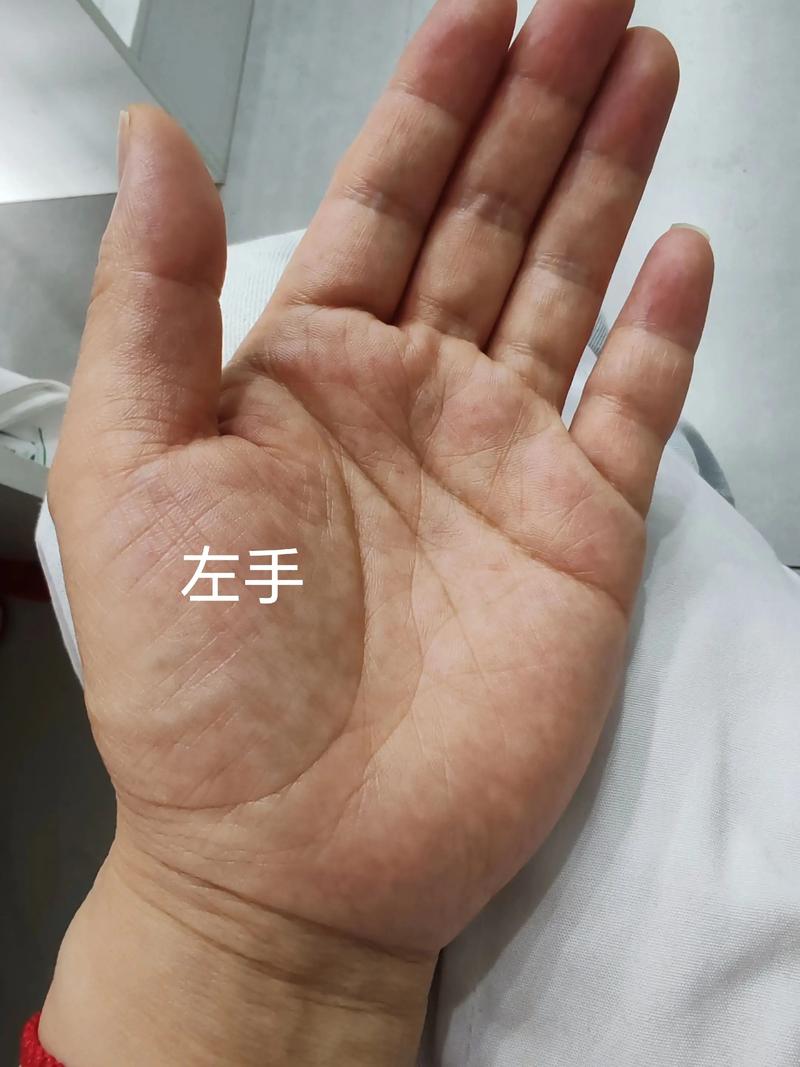 看掌纹算命真的有科学依据吗？