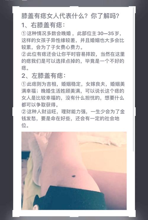 女人右腿膝盖窝有痣，这预示着怎样的命运呢？