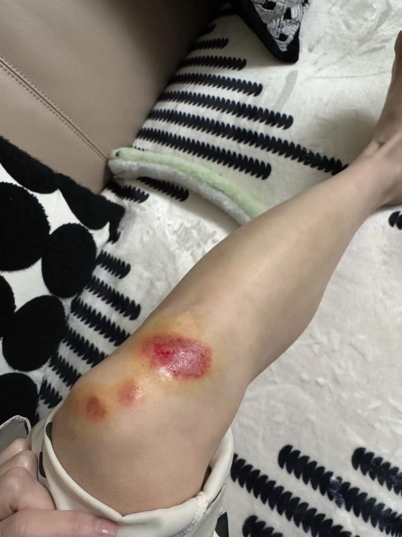 孕妇梦见骑电动车摔倒预示着什么？