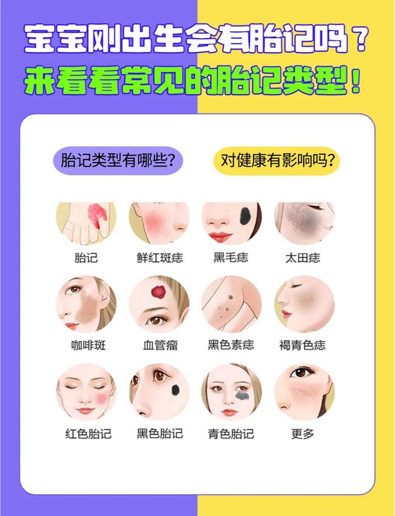 佛说脸上有胎记的人或孩子，他们有什么特殊含义或命运吗？