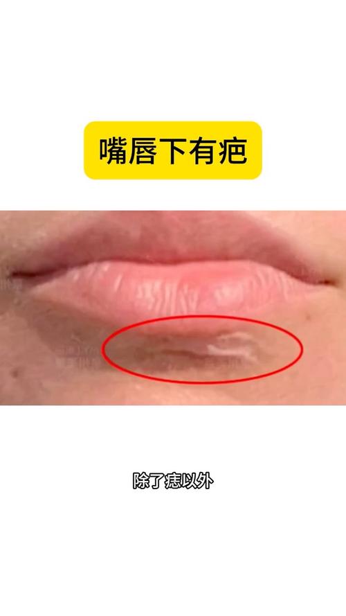 下唇有疤面相如何化解或改善？