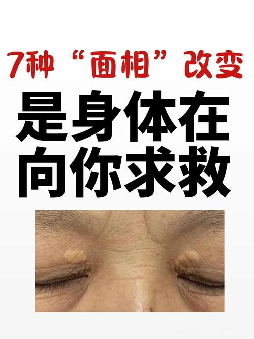 人中非常浅几乎看不见，这是不是某种疾病的表现？
