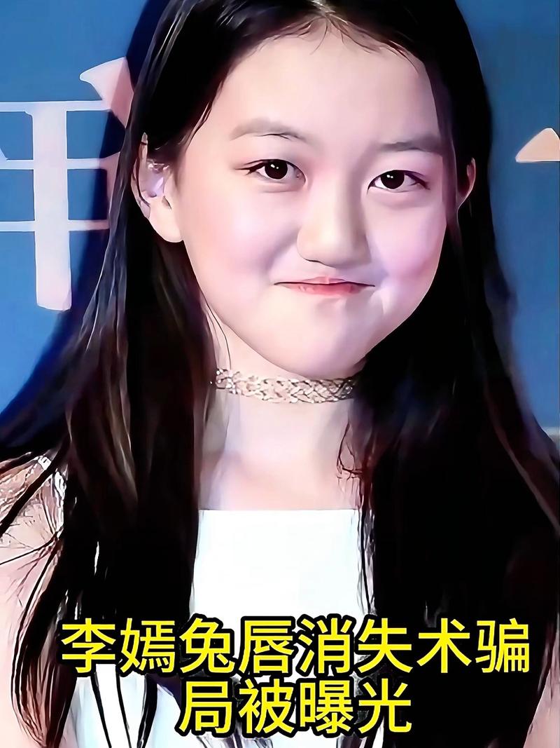 女人面相兔唇嘴巴凸出是否面相不佳？