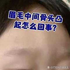 两眉中间肉凸起，是眉骨中间突出引起的吗？