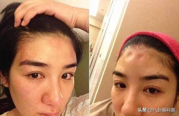 人老面相变丑的原因是什么？吸毒面相为什么会变得难堪？