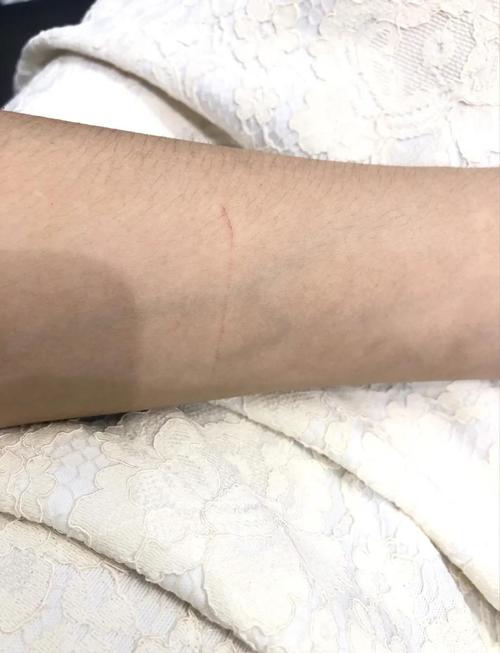 女人梦到被猫抓伤手是什么征兆？预示着什么不好的事情即将发生？