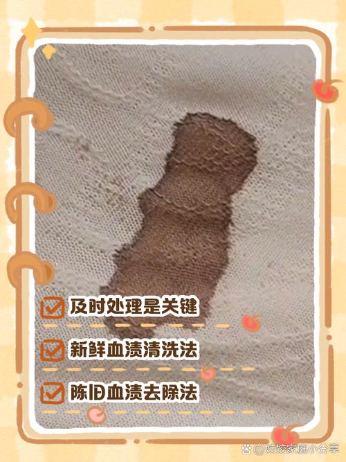 梦见衣服上血迹是什么预兆，预示着什么是好是坏？