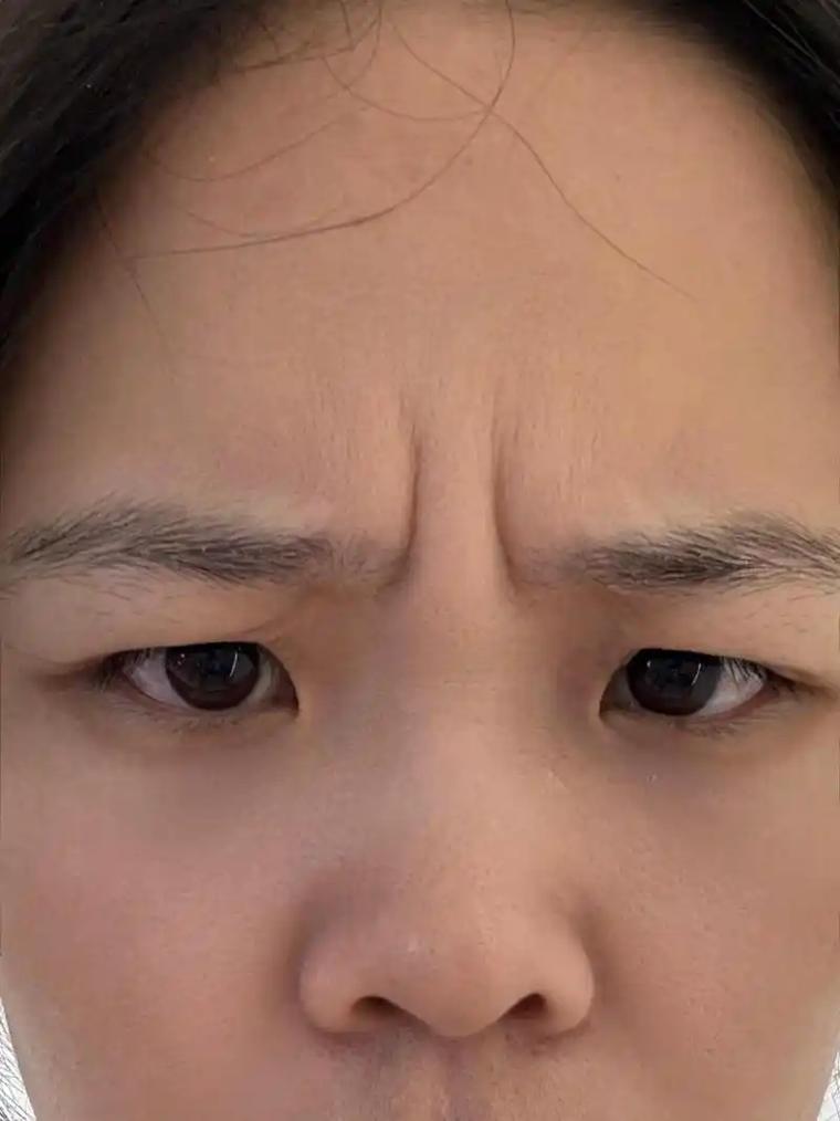 两眉毛之间有竖纹，这是否意味着我的命宫运势不佳呢？