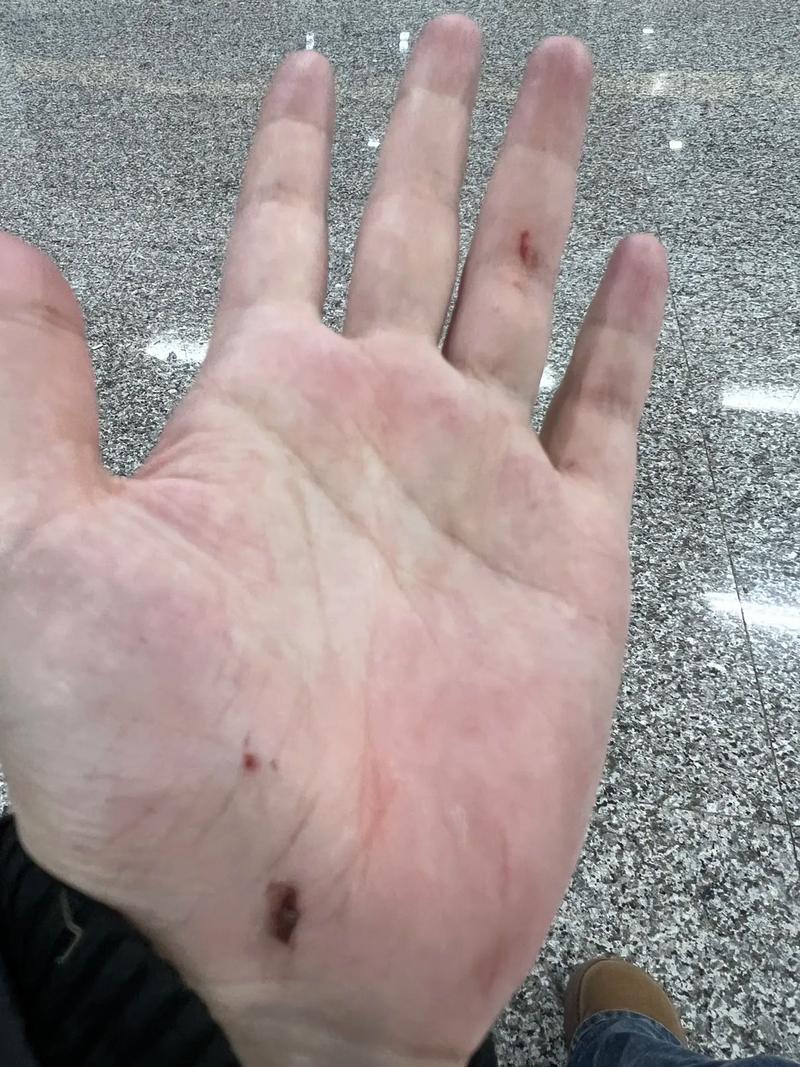 梦见孕妇开车摔跤预示着什么？有什么特殊含义吗？