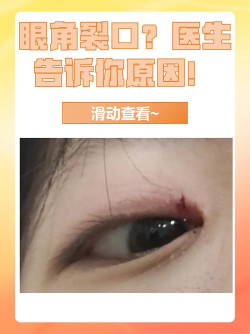 梦见眼角被砍或裂开，预示着什么不幸或警告？