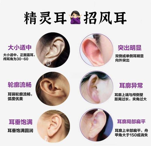 精灵耳和招风耳面相分别是什么？