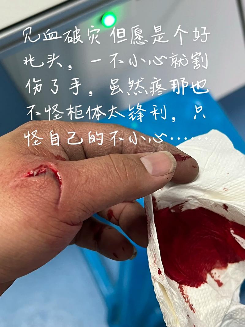 已婚女人梦见手指割破流血是什么征兆或含义？