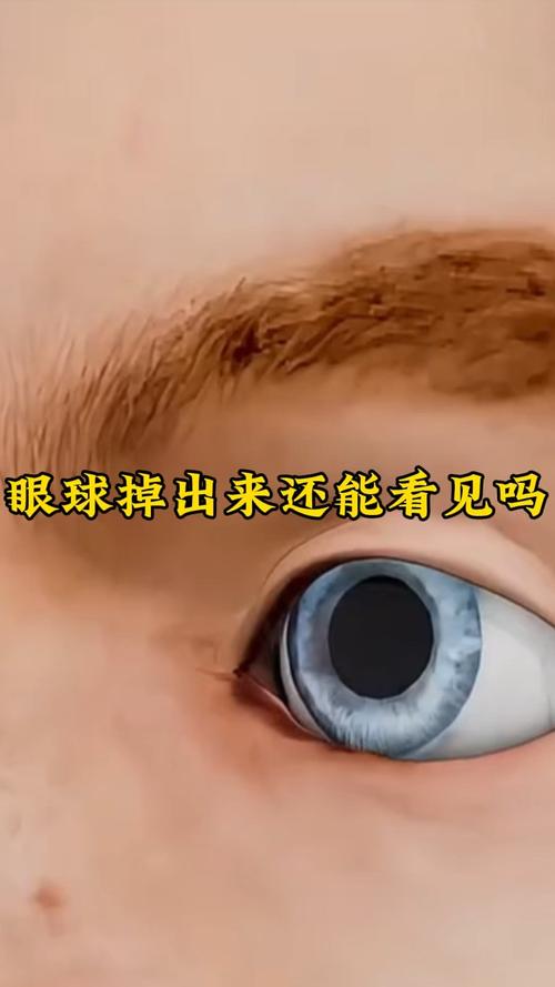 梦见别人眼珠掉落，这预示着什么不好的征兆？