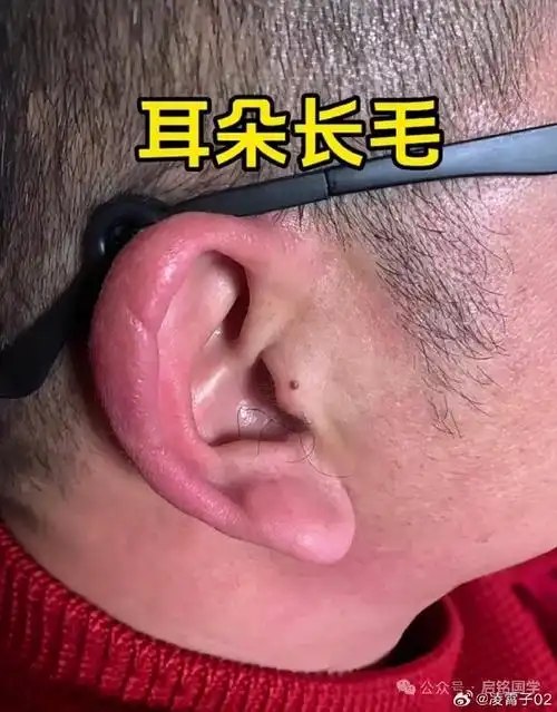 耳朵洞口长毛是预示着什么好运的征兆呢？