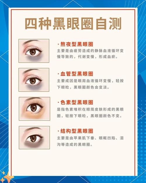 女孩天生黑眼圈面相究竟在面相学中代表着什么含义？