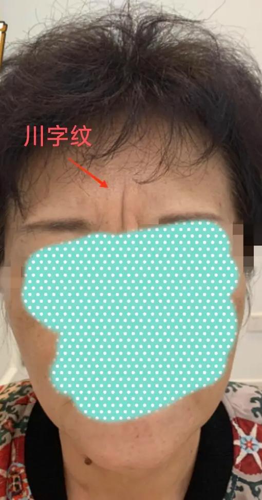 女人恶妇面相特征有哪些？五种恶毒女人面相特点是什么？