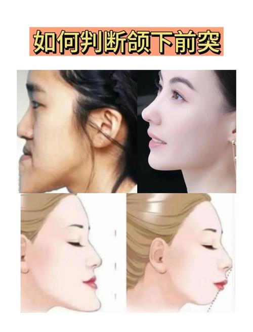 下巴前突的女生面相代表什么含义？