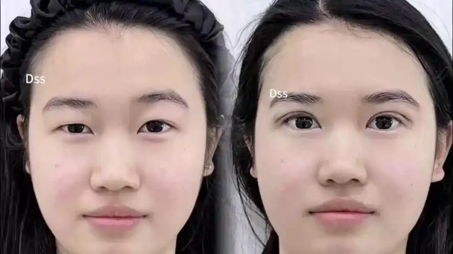 女性大小眼面相，右眼小的人面相如何？