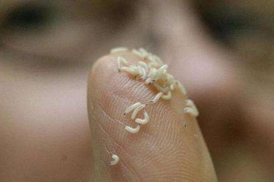 女人梦见茅坑里成群蛆虫蠕动，这是什么征兆？