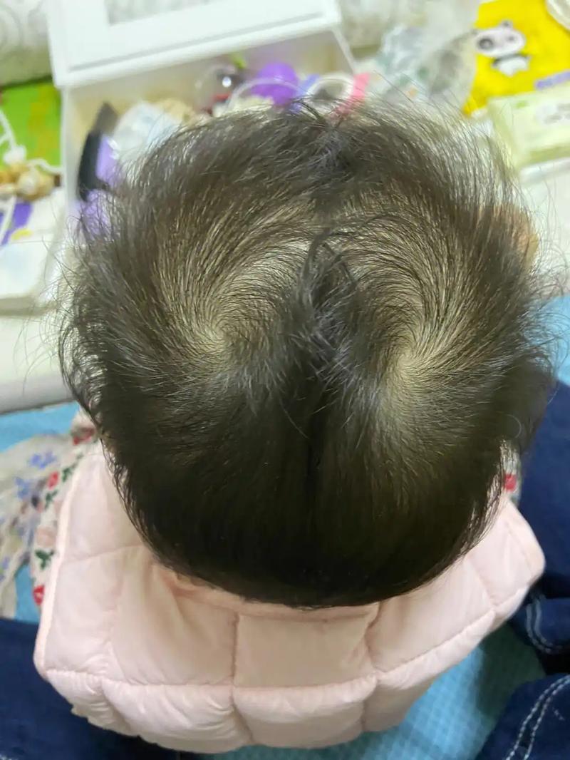 女孩头顶双旋，这对父母会面临怎样的命理挑战呢？