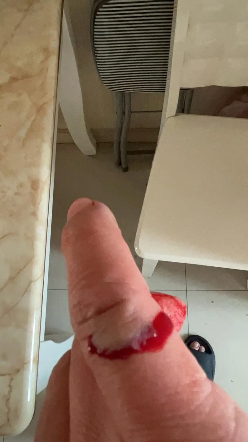 孕妇怀孕期间梦见手指被割破流血是什么征兆或含义？