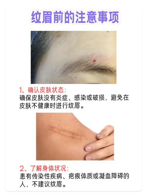 梦见绣眉一夜掉光，这预示着什么征兆？