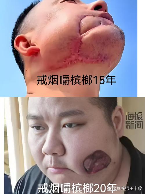 抽烟的人面相有什么特征或变化？