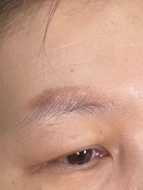 眉毛上方为何有弧形凸起，是正常现象吗？