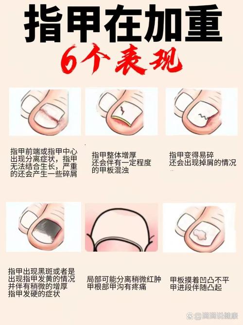 梦见老公帮我做指甲是什么预兆？