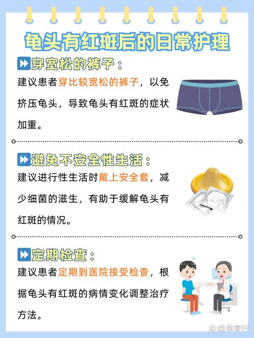 龟毛男人的特征究竟是什么他们的性格特点有哪些？
